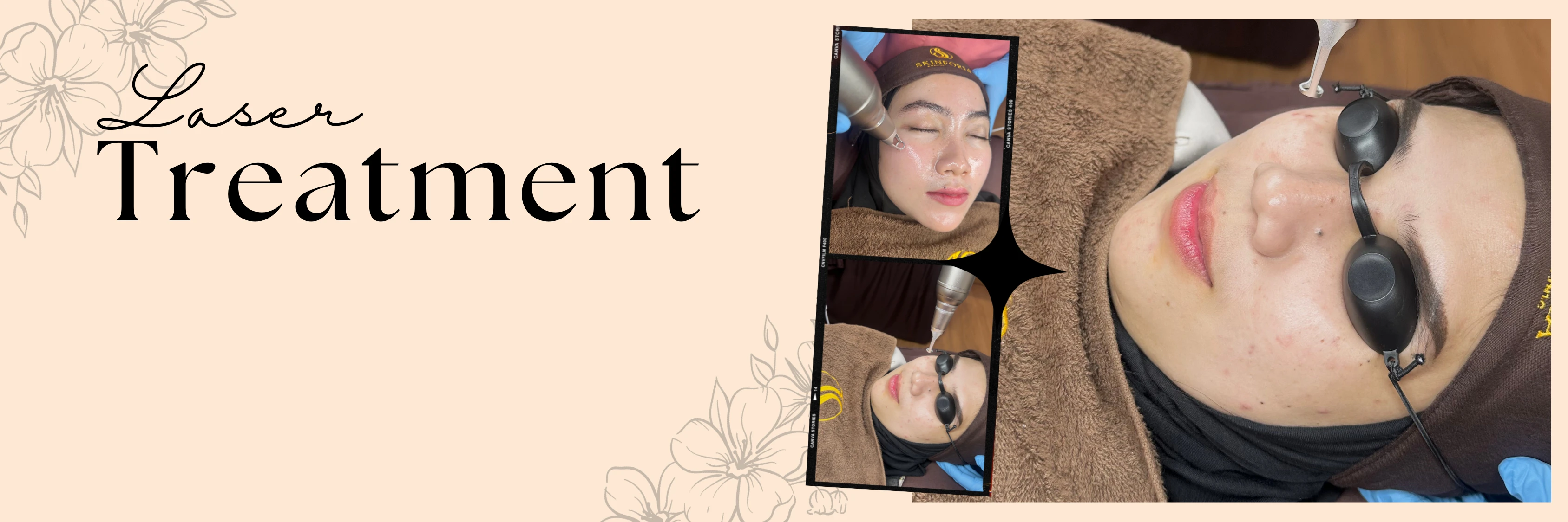 banner-treatment